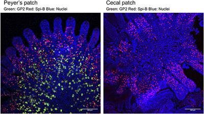 The Roles of Peyer's Patches and Microfold Cells in the Gut Immune System: Relevance to Autoimmune Diseases